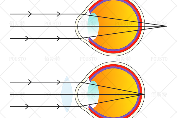 反射,焦點,透鏡設計
